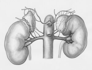 Adenoma: Comprendiendo el origen de los tumores benignos