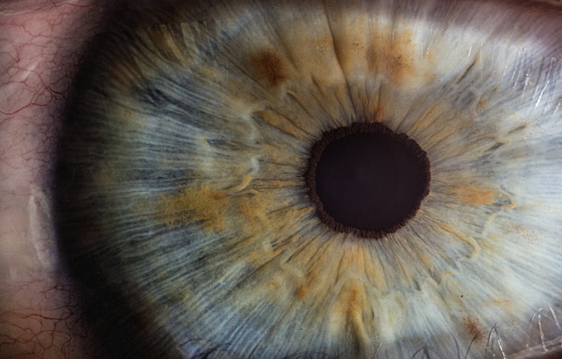 Ambliopía: El misterio del ojo perezoso en el cerebro