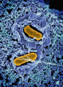 Antimetabolitos: El saboteador silencioso de las células