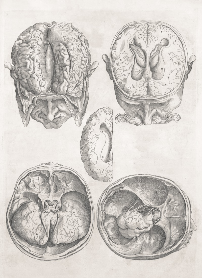 Figura Ambigua: ¿Qué nos revela tu cerebro?