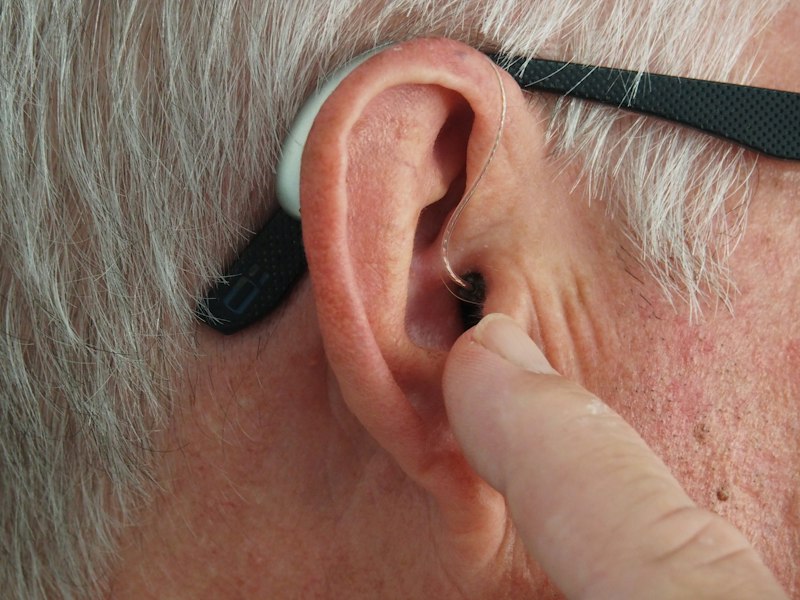 Audiometría: El mapa clínico de tu salud auditiva