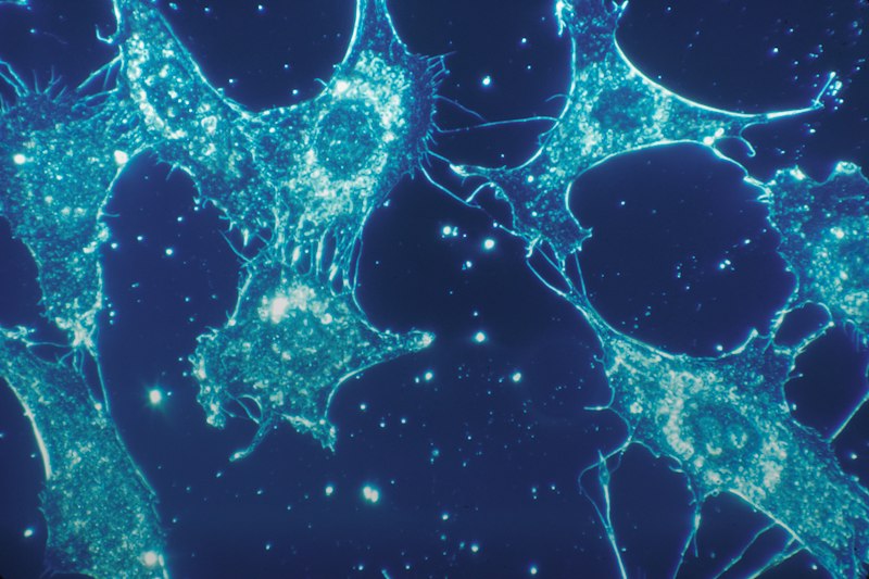 Axotomía: El impacto biológico tras la lesión neuronal